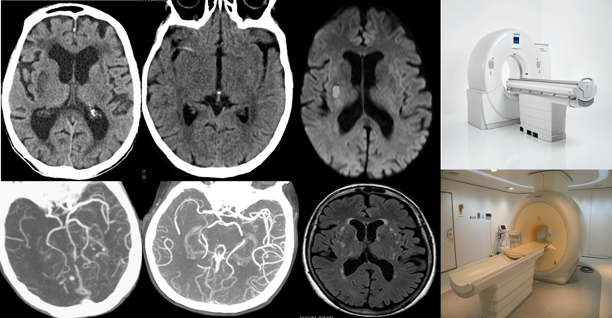 Immagine Neuroimaging Rete Ictus Modulo Base